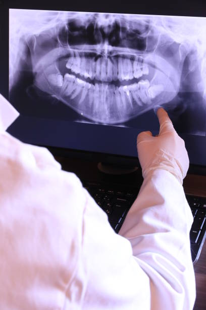 Best Dentist for Tooth Abscess  in North College Hill, OH