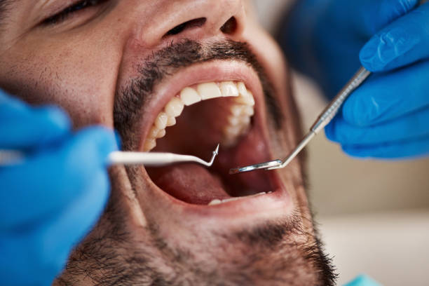 Best Root Canal Emergency Dentist  in North College Hill, OH